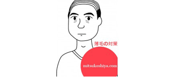 抜け毛で困っているあなたへ伝えたいフィンペシアの３つのメリットと使用注意点