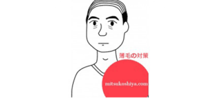 抜け毛で困っているあなたへ伝えたいフィンペシアの3つのメリットと使用注意点