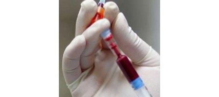 血液検査による将来のガン予測の手法が開発される。