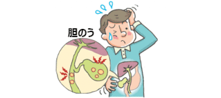 胆石をほっとくとどうなるのか!?知らないと後で怖い思いをするかも!?