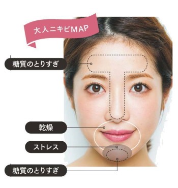 大人のニキビに効く！？ アダパレンゲルで最強のすべすべ肌に！